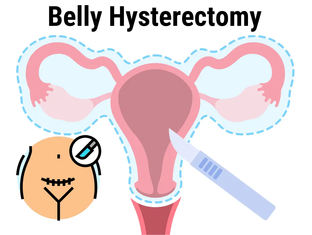 Belly Hysterectomy