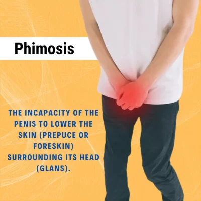 phimosis