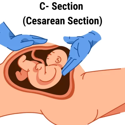 C- Section