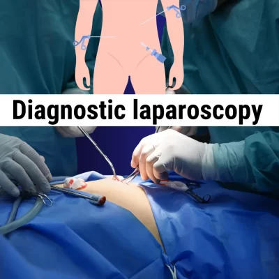 DIAGNOSTIC LAPAROSCOPY