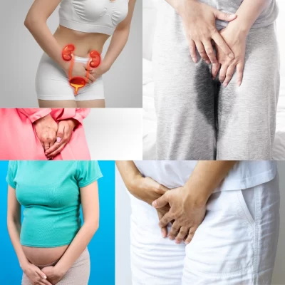 URINARY LEAKAGE_INCONTINENCE