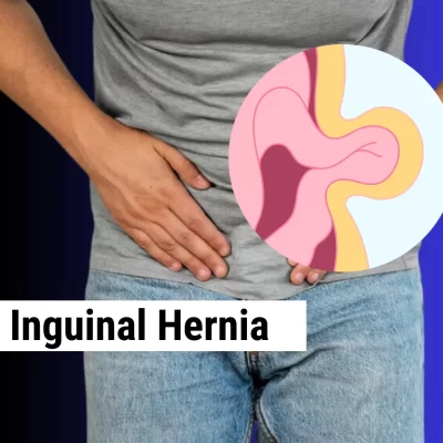 inguinal hernia